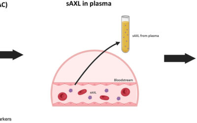 Un test rápido en sangre podría facilitar la detección precoz del cáncer de páncreas